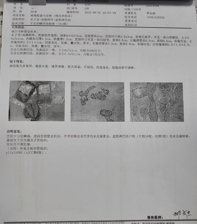 3fd215d101b3b122466224b18f910b6.png